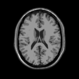 ./im/brainweb_t1.jpg