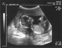 ./im/echographie-3-9e426.jpg